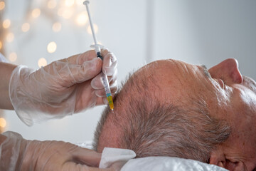 Hair Restoration